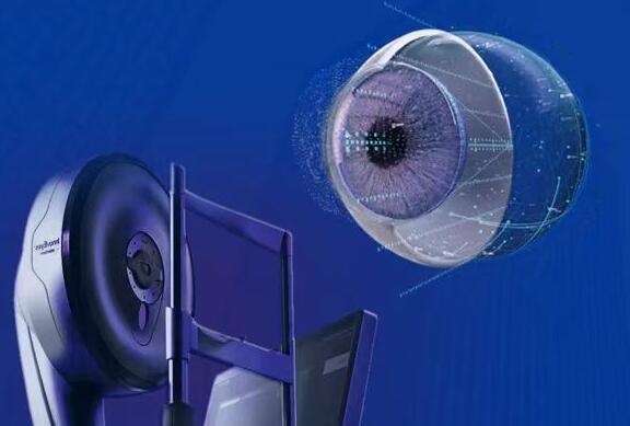 顺德首批全光塑病例已完成手术！顺德爱尔揭秘应用“全光塑”个性化屈光矫正手术